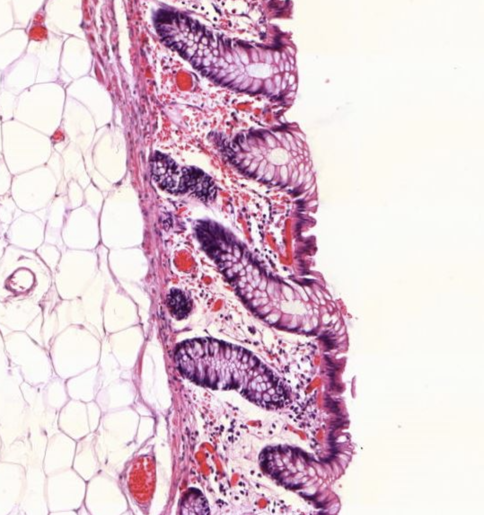 Histopathologisches Bild: Kolonschleimhaut